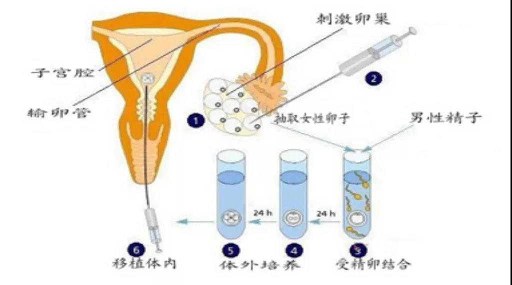【微课笔记】莫让输卵管问题成了精卵相遇的拦路虎