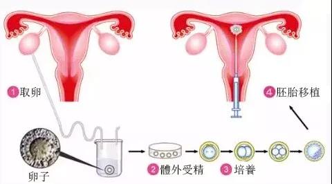 【医声】试管婴儿想做就做？