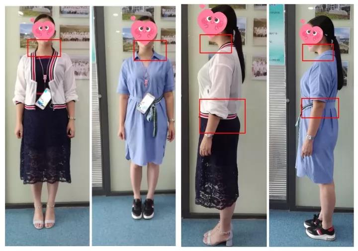 【好孕故事】怀不上原来是它作怪！