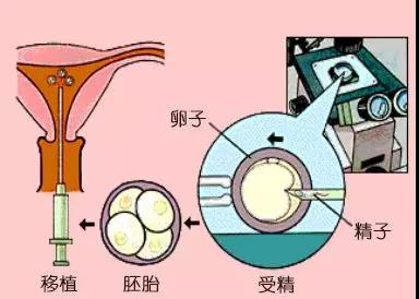 “助孕绿色通道”为东莞市民开启“幸孕之门”